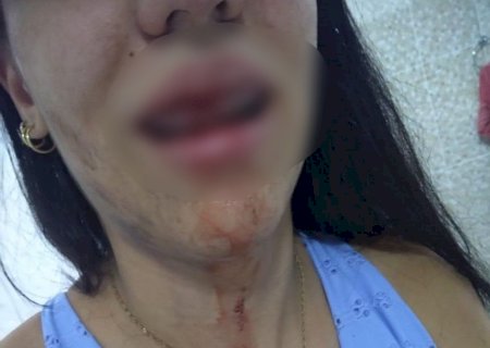 ‘Não tomem mais nenhum soco’, desabafa modelo agredida pelo namorado em MS