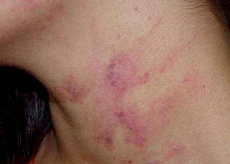 Mulher conhece homem pelo Facebook e é espancada dentro de motel no 1º encontro