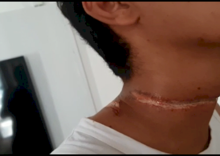 Motociclista quase &eacute; degolado ao se enroscar em fios de telefonia