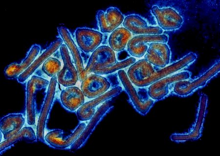 Prefeitura emite alerta para v&iacute;rus da fam&iacute;lia do Ebola, de alta letalidade