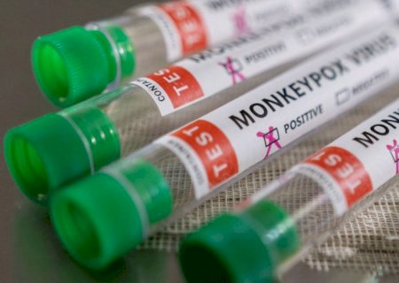 Anvisa recebe pedido de registro para teste de varíola dos macacos>