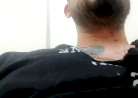 Acusado de agredir namorada em motel afirma que se defendeu a foi cortado com cacos de vidro