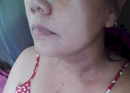 Vereadora de Ivinhema agredida por irmão expõe caso e episódio vira campanha contra \'machismo\', diz ela