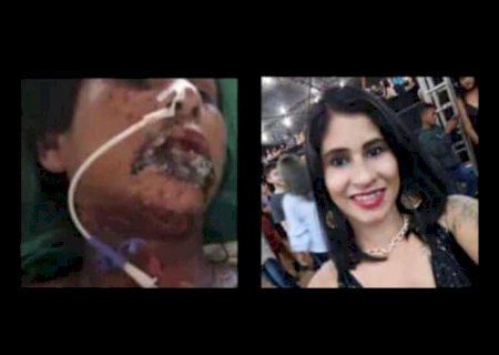 Moradora de Vicentina está na UTI devido a alergia e precisa de R$ 5 mil