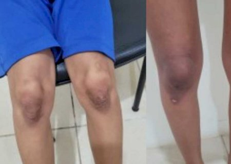 Duas mulheres são presas por torturarem adolescente e criança em Coxim