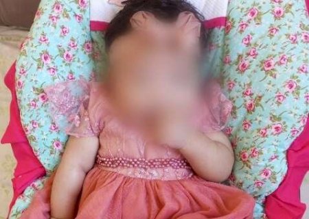 Família corre contra o tempo para salvar braço de bebê vítima de lesão no parto