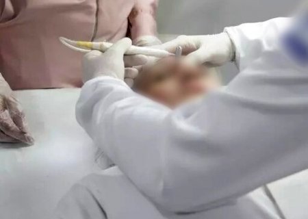 Conselho de Medicina libera uso de fenol mesmo após proibição sanitária>